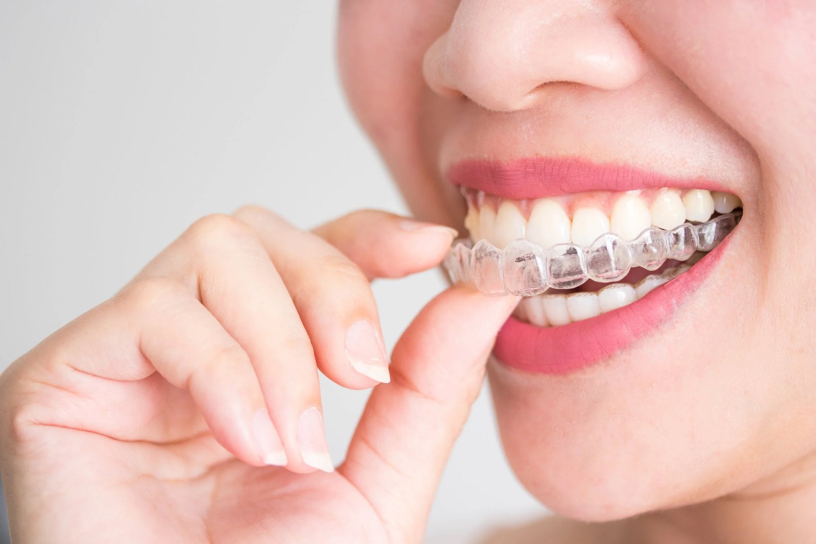 A clear aligner held near the teeth